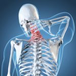 Neck Pain – What You Need to Know